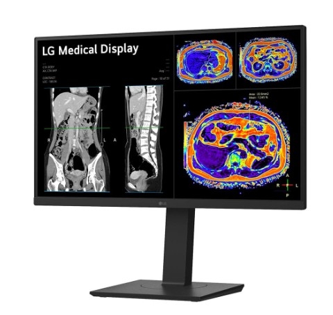 Monitor de revisão clínica LG 27HS713C-B IPS de 27" e 8MP 16:9 8MP 4K HDMI DP USB-C HAS PIVOT MEDICO 