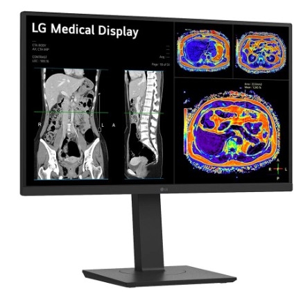 Monitor de revisão clínica LG 27HS713C-B IPS de 27" e 8MP 16:9 8MP 4K HDMI DP USB-C HAS PIVOT MEDICO 