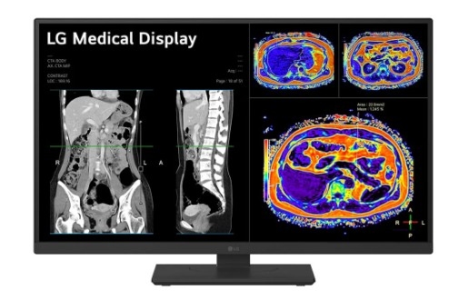 Monitor de revisão clínica LG 27HS713C-B IPS de 27" e 8MP 16:9 8MP 4K HDMI DP USB-C HAS PIVOT MEDICO 